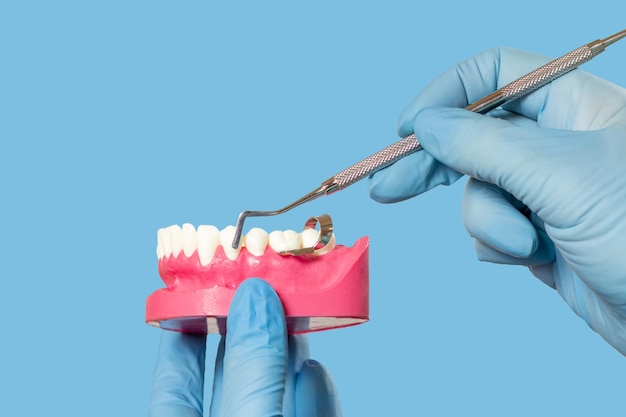 Mani del dentista con disposizione della mascella umana e curette