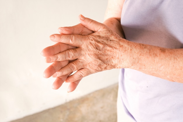 mani della vecchia donna che si sfregano insieme con le lentiggini e le rughe