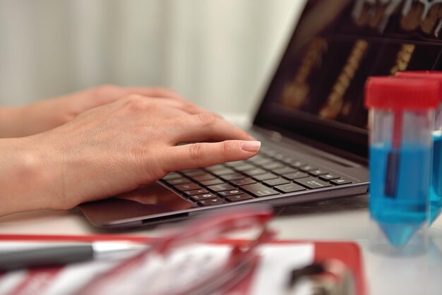 Mani di Octor che digitano sul computer portatile