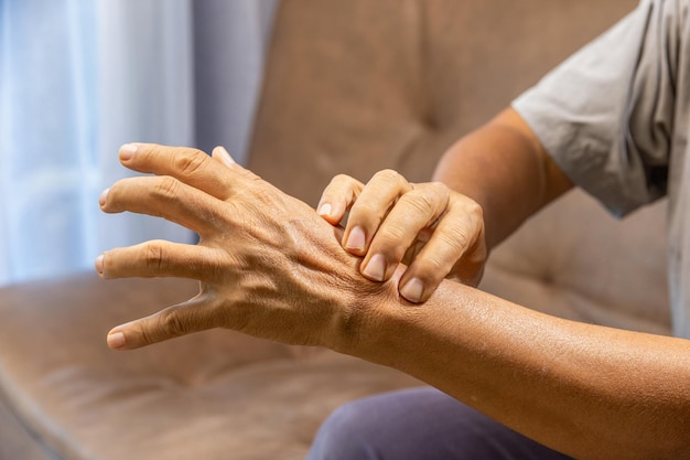 Mano dell'uomo anziano che soffre di dolori articolari con infiammazione della gotta