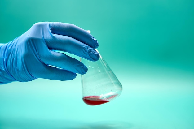 Mano di medico anonimo in flacone conico con campione chimico rosso in laboratorio durante la diagnosi