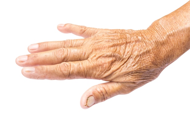 Mano tagliata di una donna anziana su sfondo bianco
