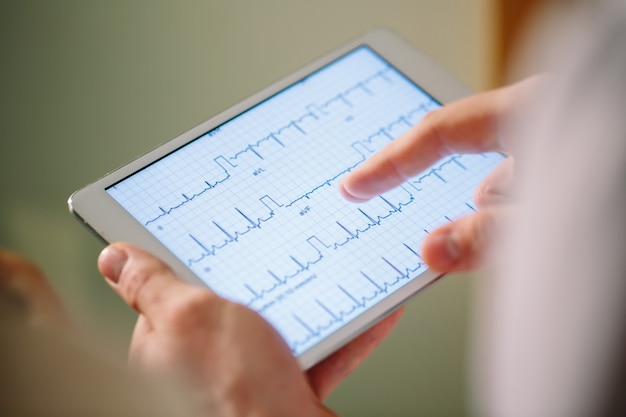Medici che discutono del cardiogramma del paziente sul tablet.