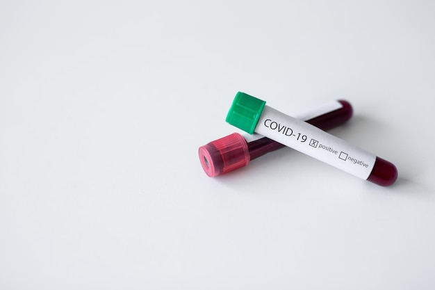 Medicina assistenza sanitaria e concetto di pandemia provette per analisi del sangue di coronavirus covid19 su sfondo bianco con spazio per la copia