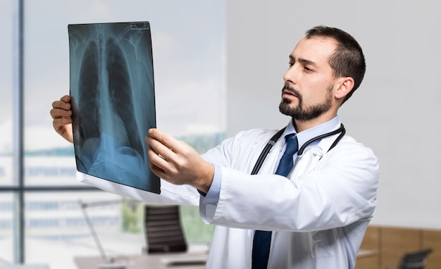 Medico che esamina una radiografia del torace