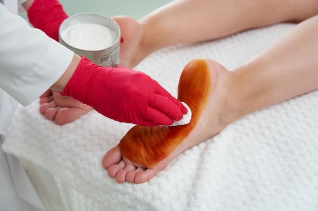 Medico che si prepara a fare iniezioni di tossina botulinica nei piedi femminili contro l'iperidrosi