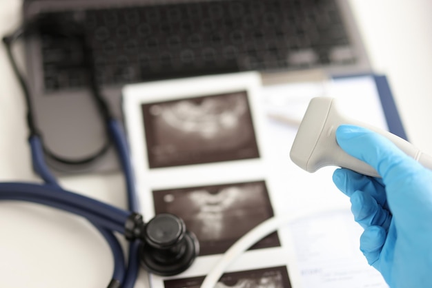 Medico che tiene la sonda a ultrasuoni sullo sfondo di immagini e documenti medici in primo piano