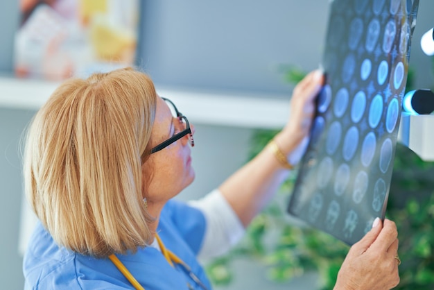 Medico della donna che controlla la diagnosi sull'immagine del film. Foto di alta qualità