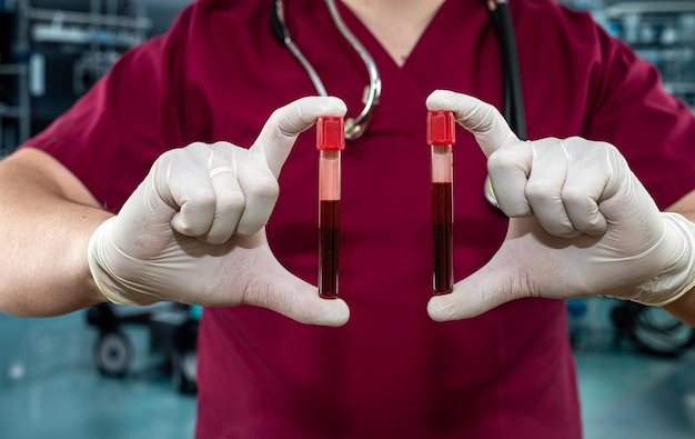 Medico in uniforme rossa che tiene il sangue nella provetta per il coronavirus nell'ospedale di laboratorio