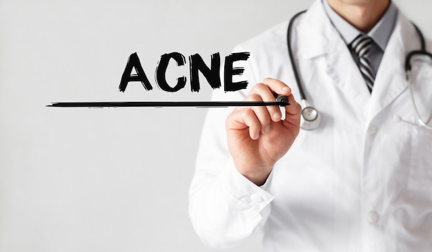 Medico iscritto parola Acne con pennarello, concetto medico