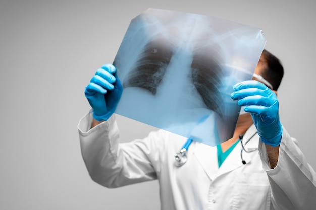 Medico maschio che esamina la scansione a raggi x dei polmoni contro il grigio si chiuda