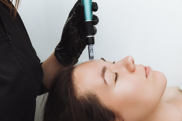 Mesoterapia cosmetica per il ringiovanimento del viso Procedura cosmetica di microneedling Il cosmetologo inietta l'acido ialuronico nel volto della paziente della ragazza con l'aiuto di dermopen