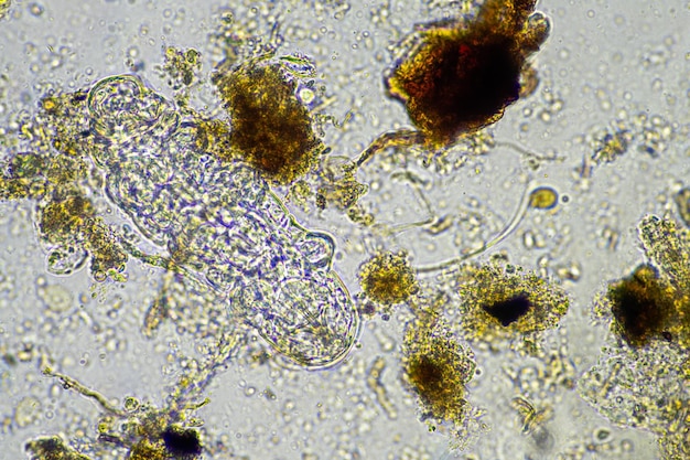 microrganismi e un tardigrado in un campione di suolo in un'azienda agricola