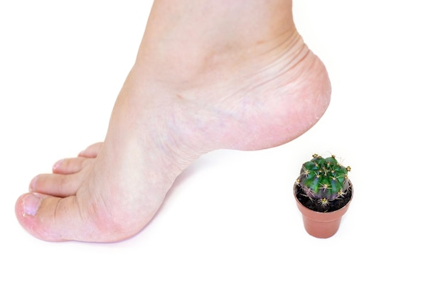 mini piante di cactus sotto i talloni delle donne o sulle dita dei piedi. talloni irritati secchi, cura del corpo della pelle