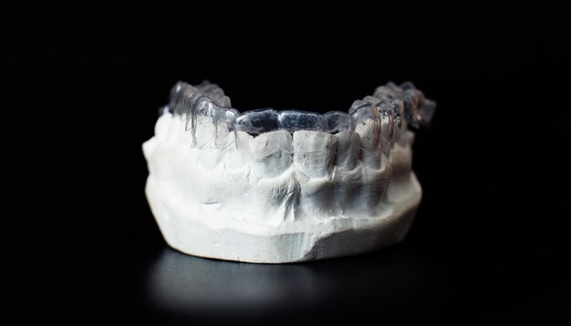 Modello di mascella dentale su sfondo nero Allineatori o bretelle dentali invisibili trasparenti applicabili per un trattamento dentale ortodontico