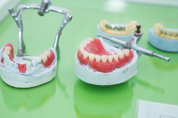 Modello di mascella sul tavolo del dentista