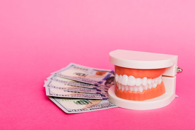 Modello di primo piano di una mascella umana con denti bianchi e banconota da un dollaro Foto concettuale di odontoiatria Odontoiatria protesica Vista dall'alto di denti falsi con spazio di copia