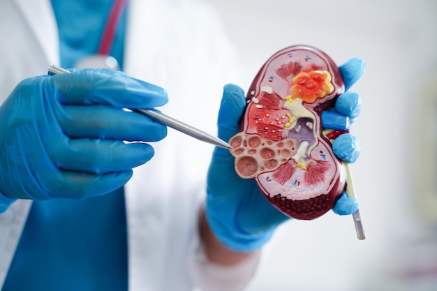 Modello di supporto medico per malattie renali croniche per il trattamento dell'urologia del sistema urinario Tasso di filtrazione glomerulare stimato eGFR