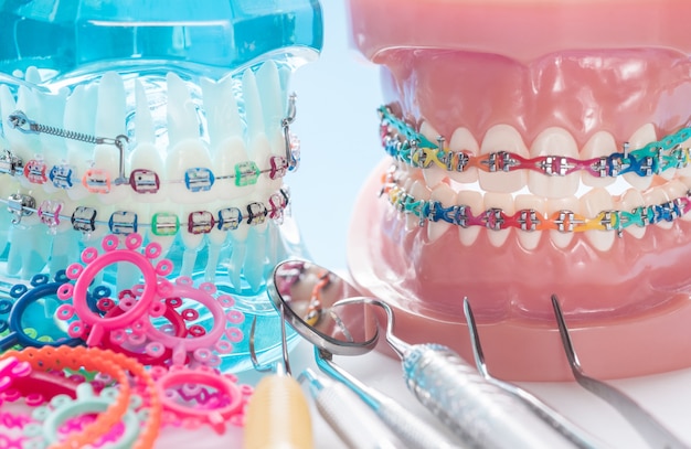 Modello ortodontico e strumento dentista