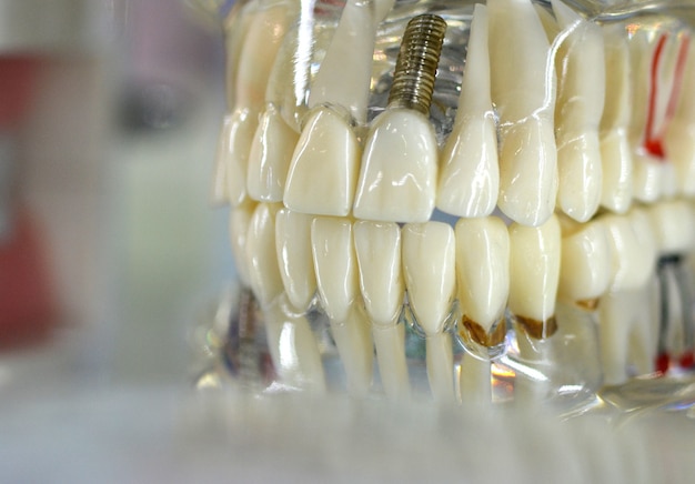 Modello trasparente di denti umani