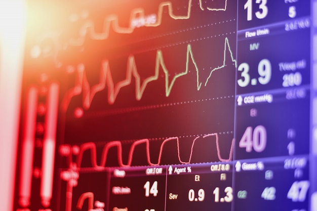 Monitor ECG in macchina a pompa a palloncino aortica intra in icu su sfocatura dello sfondo, onde cerebrali in elettroencefalogramma, frequenza cardiaca