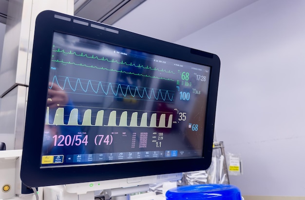 monitor ospedaliero che mostra segni vitali enfatizzando la tecnologia sanitaria e il benessere del paziente