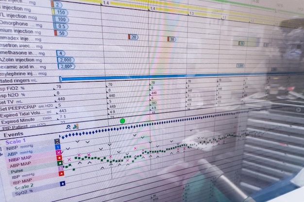 monitor ospedaliero che mostra segni vitali enfatizzando la tecnologia sanitaria e il benessere del paziente