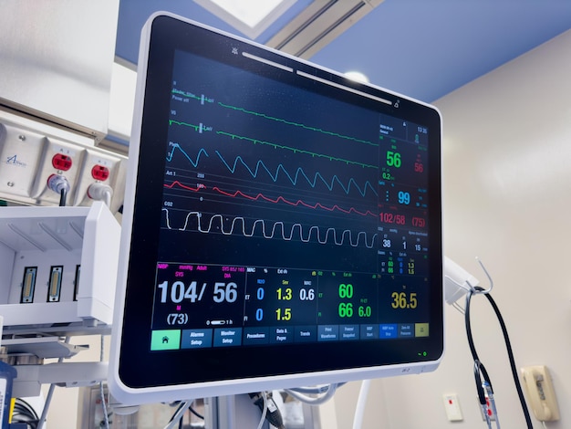 Monitor ospedaliero visualizza i segni vitali concetto di assistenza sanitaria attrezzature mediche monitoraggio della salute del paziente