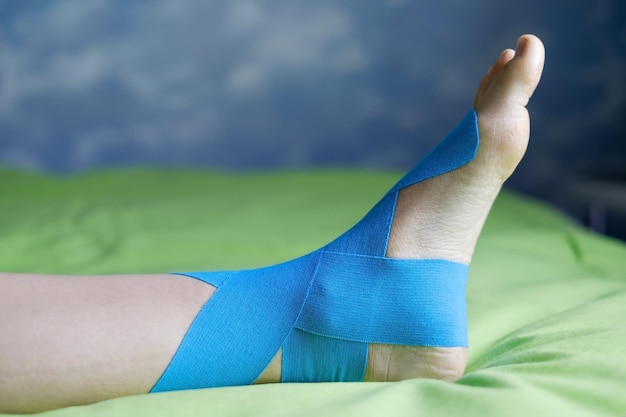 Nastro elastico terapeutico blu applicato alla gamba sinistra del paziente