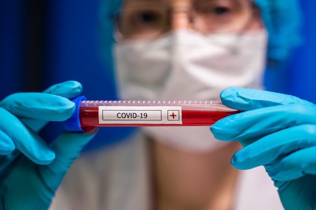 Nuovo virus corona epidemico. Epidemia di corona virus. Corona Virus in Lab. Scienziato tenere la provetta con analisi del sangue con il nome del virus Coronavirus. vaccino