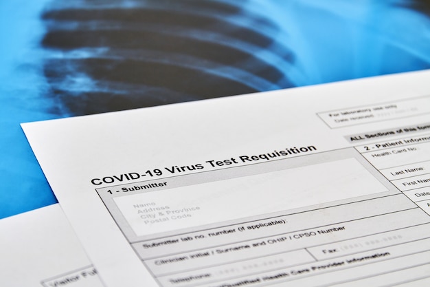 Parte del test del virus COVID-19 Modulo di richiesta sullo sfondo della radiografia polmonare. Concetto di protezione dal Coronavirus. Avvicinamento