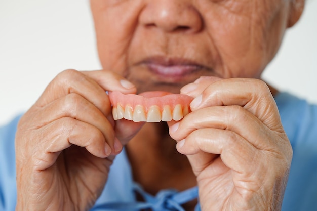 Paziente donna anziana asiatica che tiene la dentiera in mano per masticare il cibo