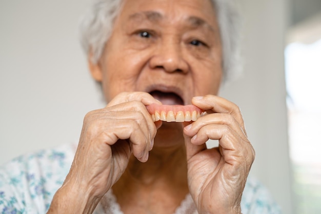 Paziente donna anziana asiatica che tiene per usare il concetto medico forte e sano della protesi dentaria