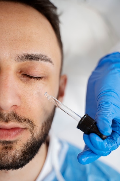 Paziente sottoposto a procedura di microneedling