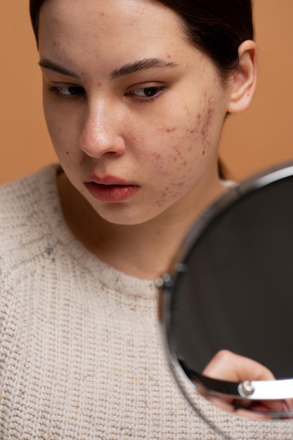 Persona che ha a che fare con la rosacea
