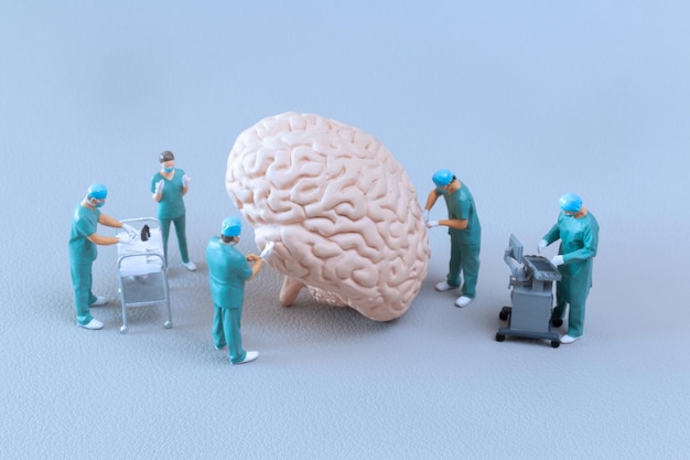 Persone in miniatura Modello cerebrale di controllo e analisi del medico su sfondo bianco Concetto di scienza e medicina