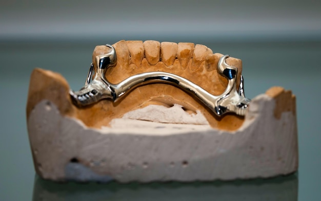 Piastra dentale in porcellana di zirconio nel negozio di dentisti Foto