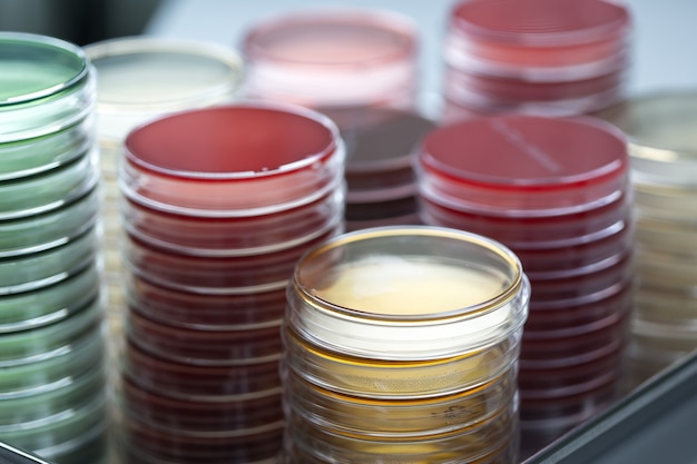 Piastre di Petri rosse e gialle impilate nel laboratorio di microbiologia sullo sfondo del laboratorio di batteriologia. Concentrati sugli stack.