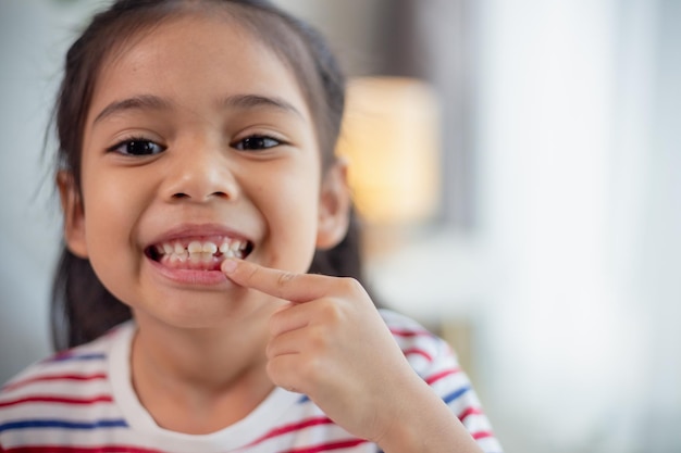 Piccola ragazza asiatica che mostra i suoi denti da latte rotti