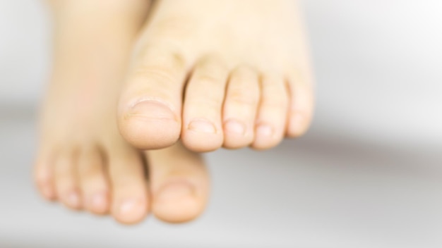 Piedi sporchi dei piedi di un ragazzino Sporco sotto le unghie Su uno sfondo bianco