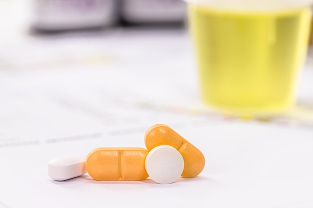 Pillole e farmaci per l'incontinenza urinaria orale con bottiglia di urina nel laboratorio di test in background