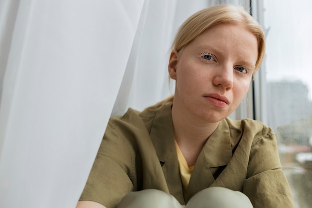 Posa della donna dell'albino di vista frontale