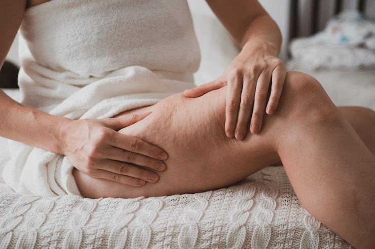Foto primo piano del corpo femminile con cellulite donna fa massaggio contro la cellulite con le mani