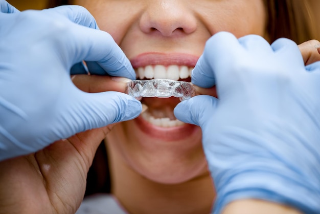 Primo piano del dentista che mostra alla paziente come utilizzare l'apparecchio ortodontico mobile per la correzione dentale.