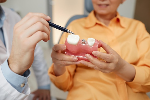 Primo piano del dentista irriconoscibile che punta al modello del dente