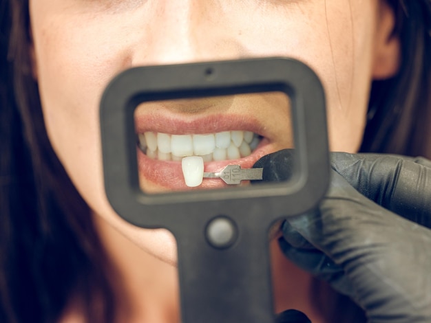 Primo piano del dentista maschio del raccolto in guanti medici in lattice con specchio dentale e strumento in acciaio cercando su protesi impiallacciata sui denti della paziente durante l'appuntamento in clinica