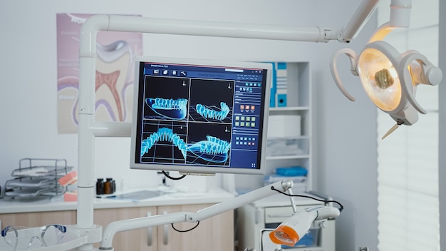 Primo piano del monitor con immagini della radiografia del dente su di esso i