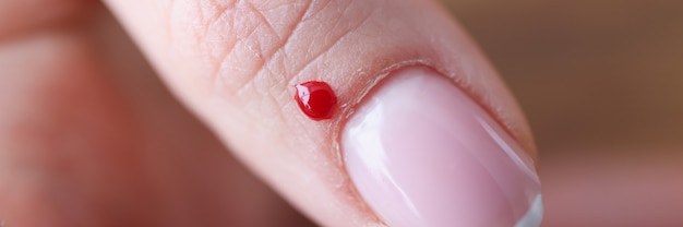 Primo piano della goccia di sangue vicino al concetto di strumenti per manicure igienizzante per unghie della donna