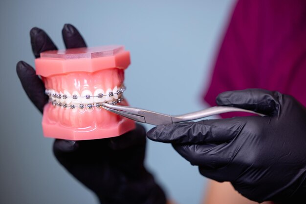 Primo piano delle mani dei medici in guanti neri che tengono modelli di denti con bretelle in ceramica sui denti