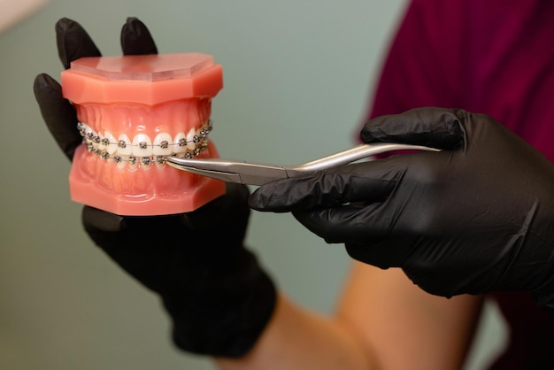 Primo piano delle mani dei medici in guanti neri che tengono modelli di denti con bretelle in ceramica sui denti